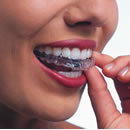 Yakubiv-Dental-Clinic-invisalign