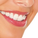 Yakubiv-Dental-Clinic-orthodontics