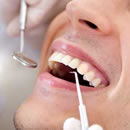 Yakubiv-Dental-Clinic-periodontal-care