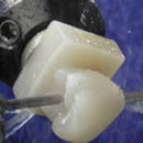 Yakubiv-Dental-Clinic-prosthetic-dentistry