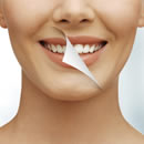 Yakubiv-Dental-Clinic-teeth-whitening