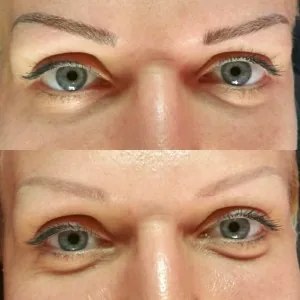 Microblading Cyprus Limassol Microblading Cyprus Limassol
