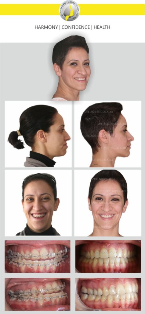 Cyprus Cranio Maxillo Facial Center