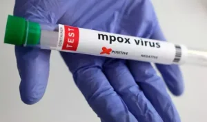 Министерство здравоохранения описывает симптомы Mpox и риски передачи
