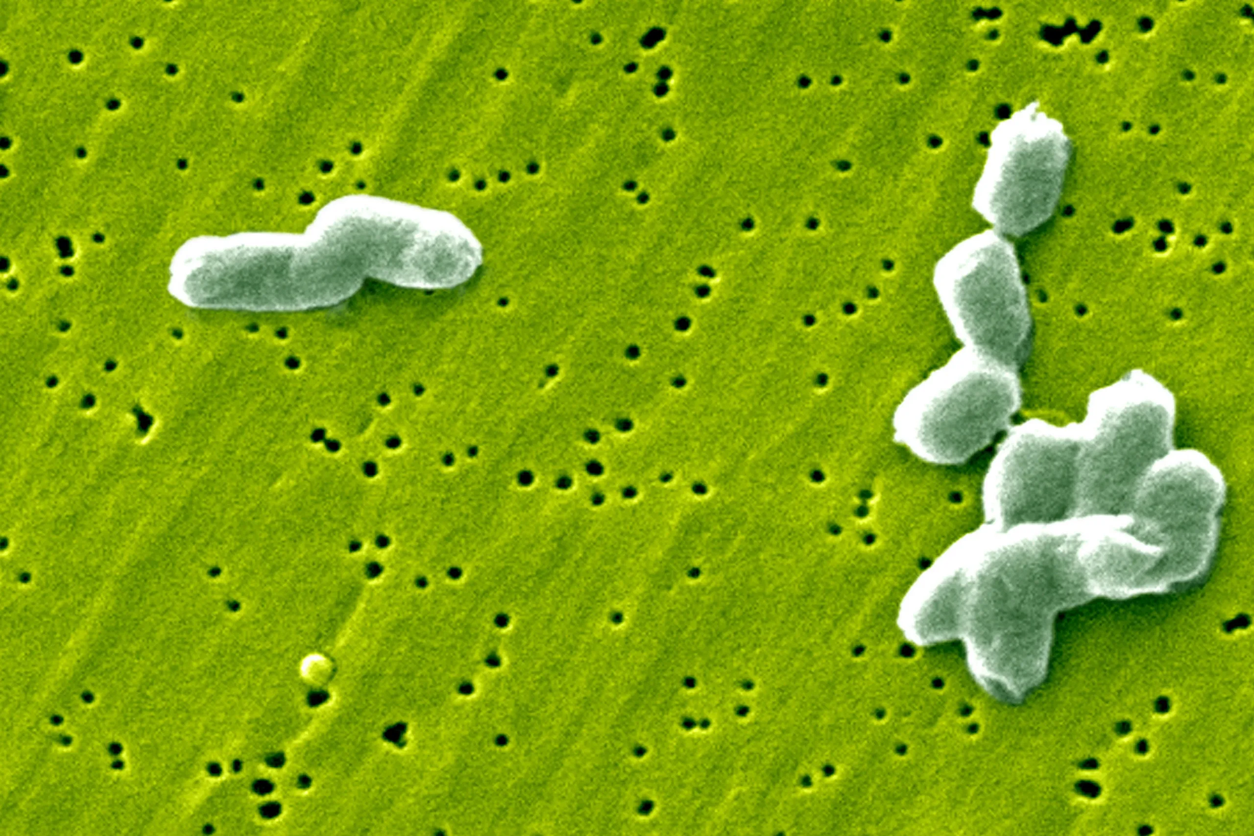 Belgian Salmonella Outbreak Linked to Eggs Infects at Least 306 People