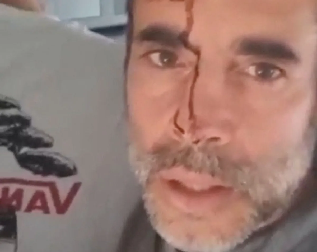 Η Σαουδική Αραβία ξεκινά έρευνα αεροπορικής ασφάλειας για την επίθεση στο πιλοτήριο αεροσκάφους της flydubai